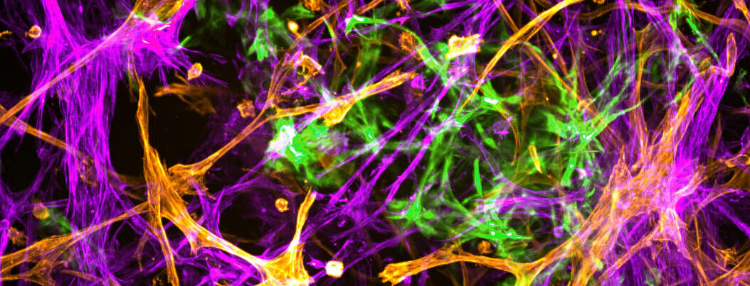 Mikroskopische Aufnahme zeigt Netzwerke von Nervenzellen.