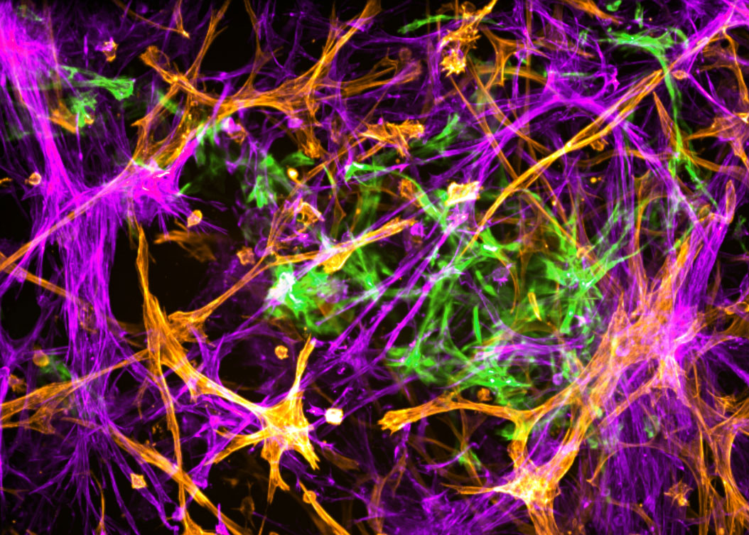 his microscopic image shows networks of neurons as they typically develop in 3D cell cultures.