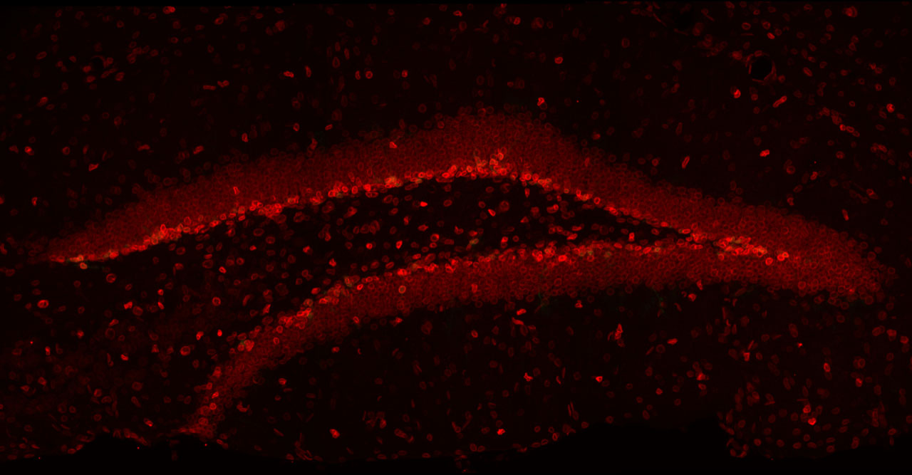 Mikroskopische Aufnahme des Hippocampus mit rot eingefärbtem lamin B1.