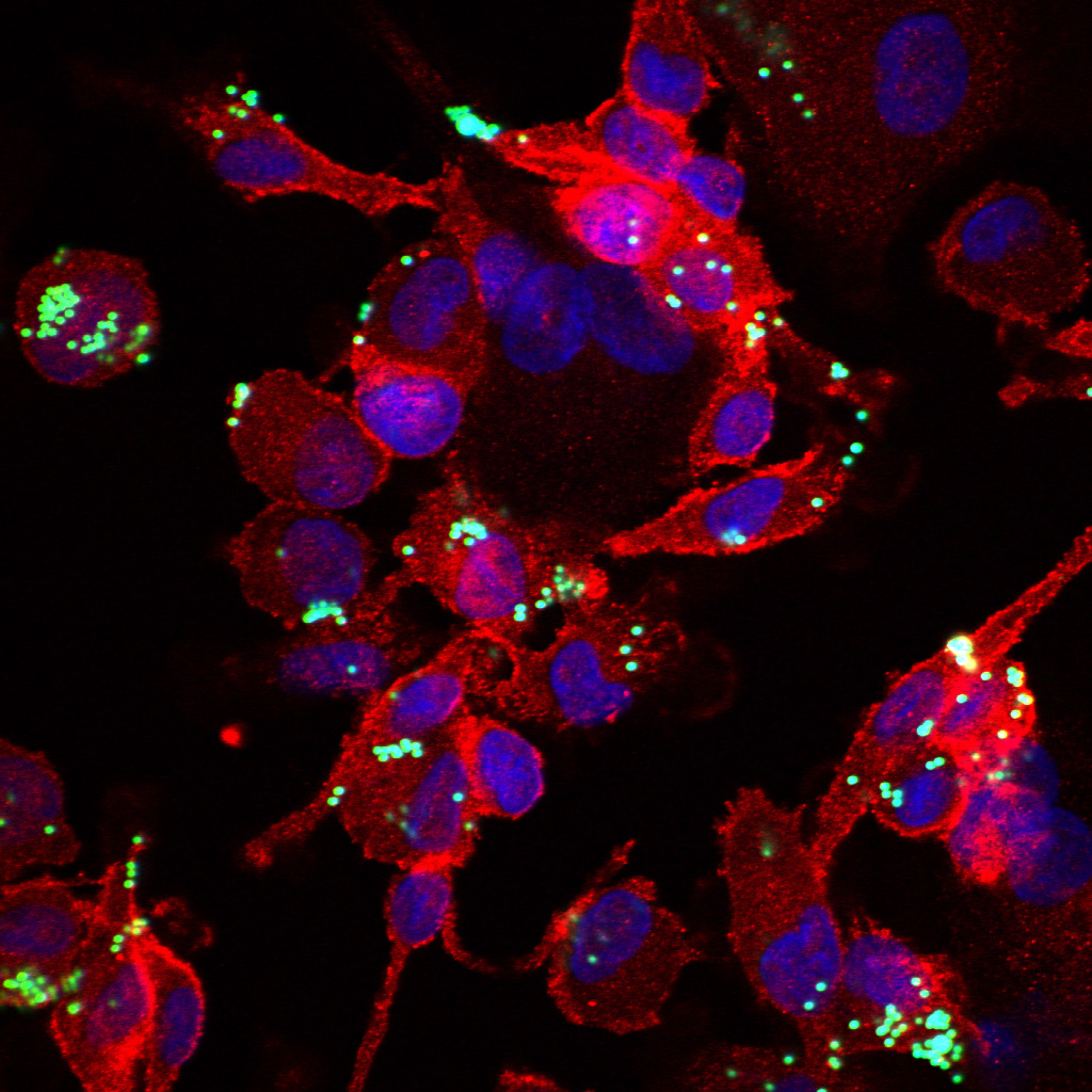 Mikrogliazellen, die aus den Stammzellen von Patienten gewonnen wurden