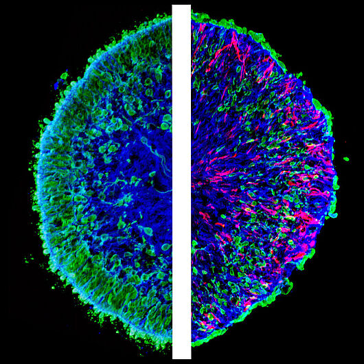 Microscopic images of lab-grown mini-retinas, so called human retina organoids. 