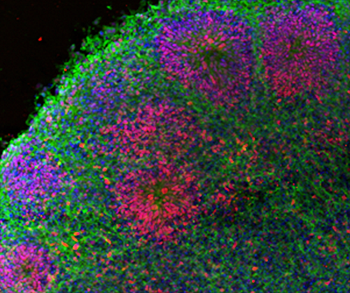 Gehirn-Organoid, das mehrere Cluster von neuronalen Zellen (in verschiedenen Farben) enthält. 