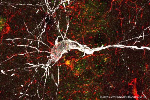 Nervenzelle (weiß) unter dem Mikroskop