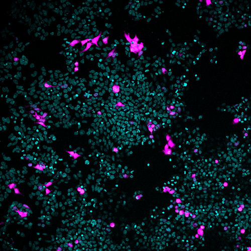 This image shows cells with artificial viruses that mimic SARS-CoV-2