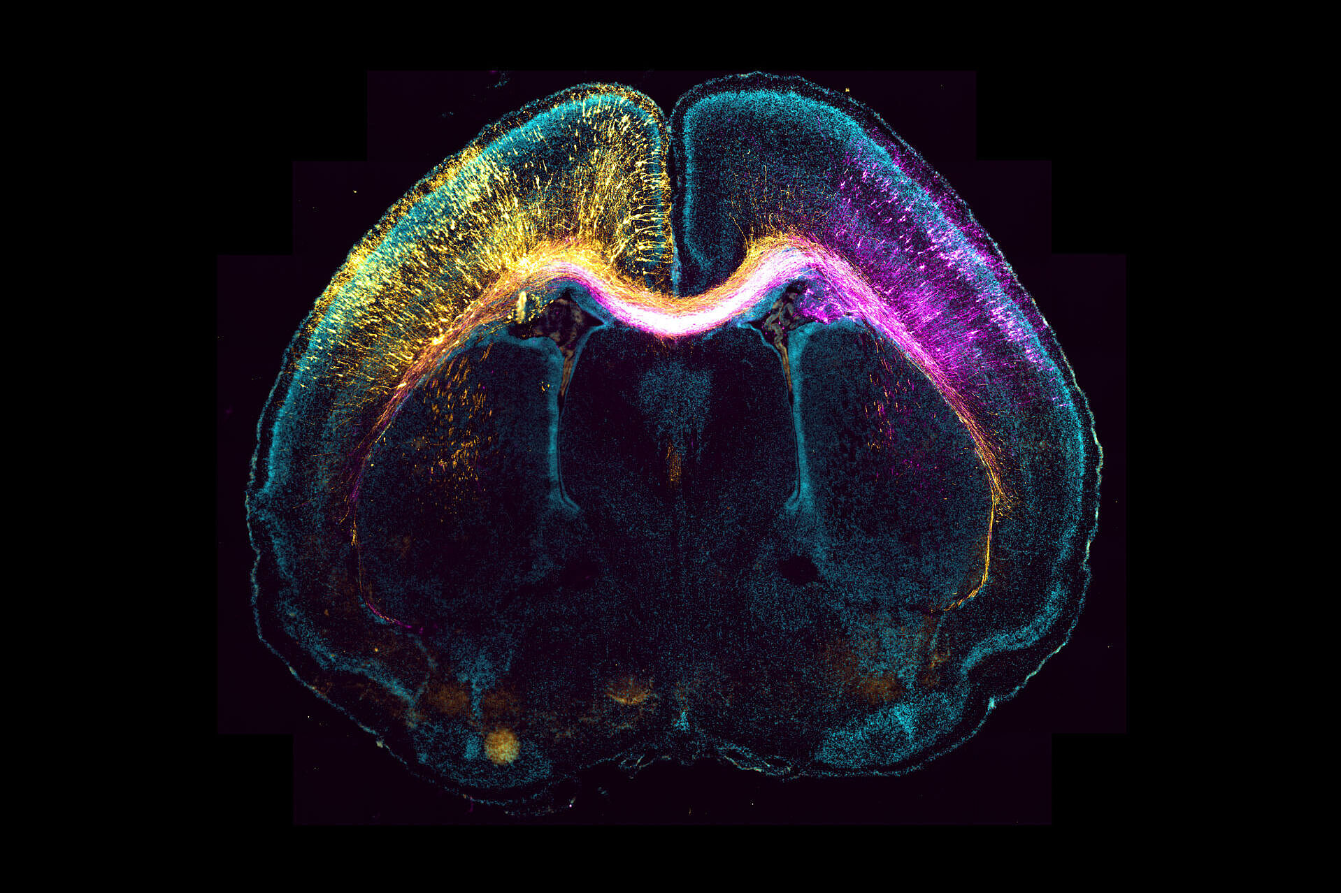 Pcture shows microscope image of a mouse brain that was genetically changed in its embryonic stage.