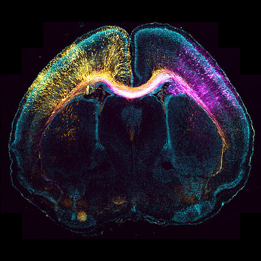 Pcture shows microscope image of a mouse brain that was genetically changed in its embryonic stage.