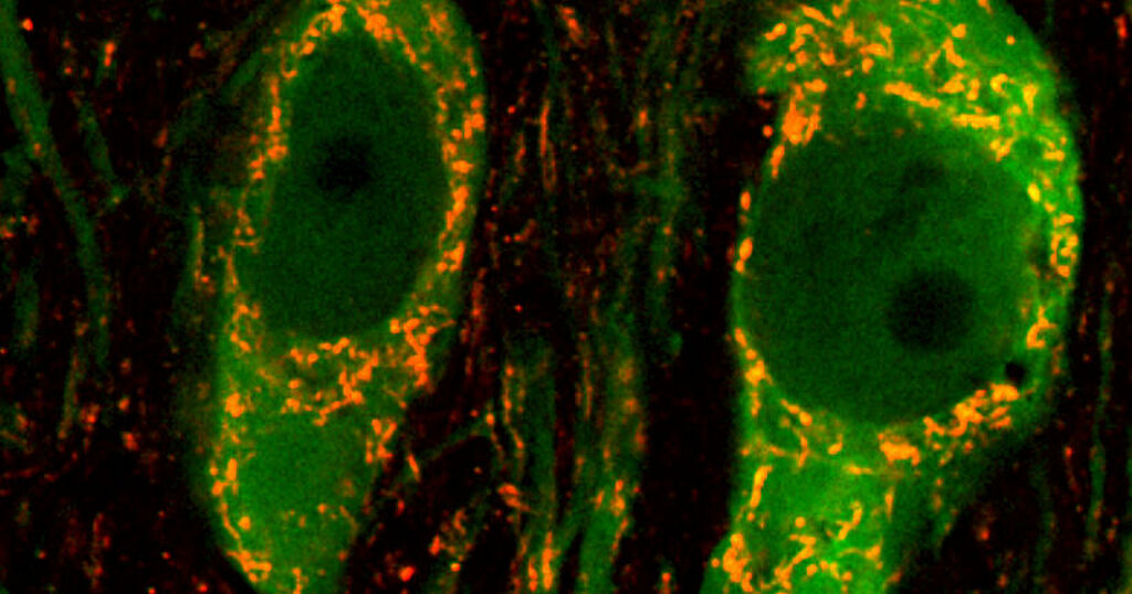 Diese Abbildung zeigt zwei Nervenzellen, die Mitochondrien sind Orange dargestellt