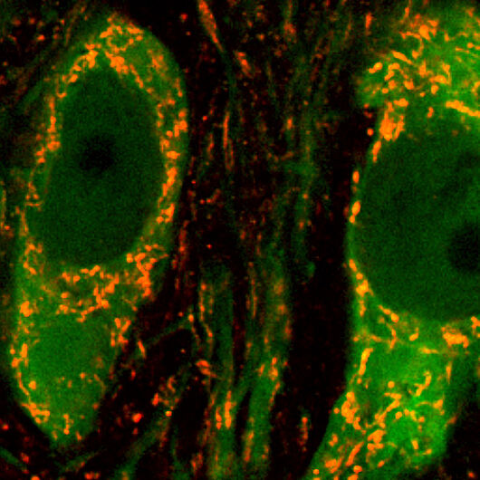 Diese Abbildung zeigt zwei Nervenzellen, die Mitochondrien sind Orange dargestellt