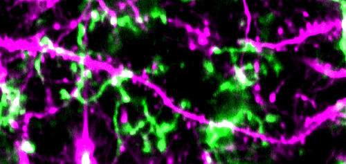 Unter dem Mikroskop: Mikroglia (grün), Nervenzellen mit Synapsen (magenta). Quelle: DZNE/Felix Nebeling