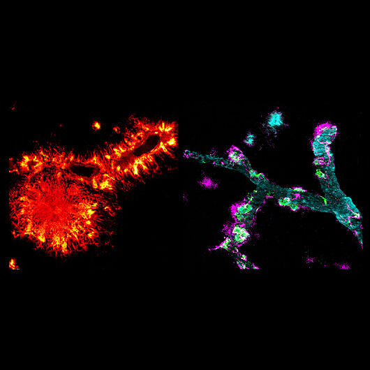 Image shows colored blood vessels