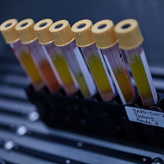This symbolic picture shows blood samples.