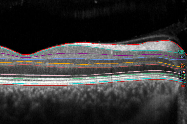 Cross-section through the human retina showing its different layers.