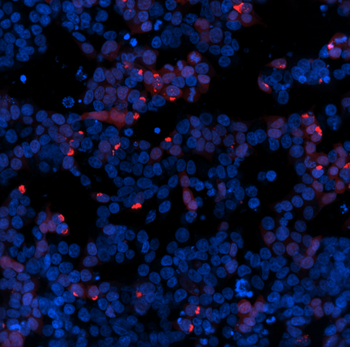 Mikroskopische Aufnahme genetischer Überreste im menschlichen Erbgut.