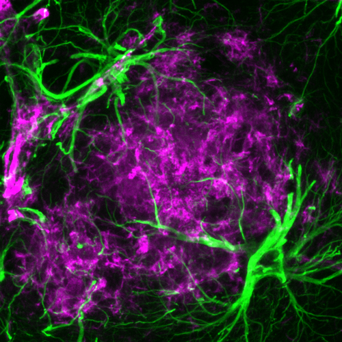 Under the microscope: Star-shaped astrocytes 
