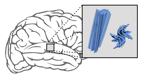 In Parkinson’s and multisystem atrophy, proteins accumulate in layers to form elongated aggregates (blue) that are deposited in the brain.