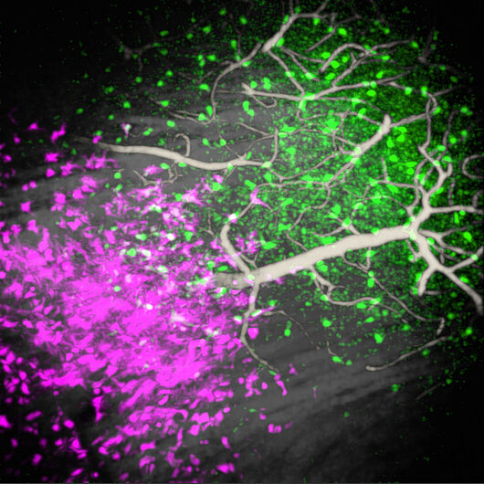 The image shows the interaction between several glioblastoma cells, marked in magenta, and immune cells, marked in green, in the brain of a living mouse.