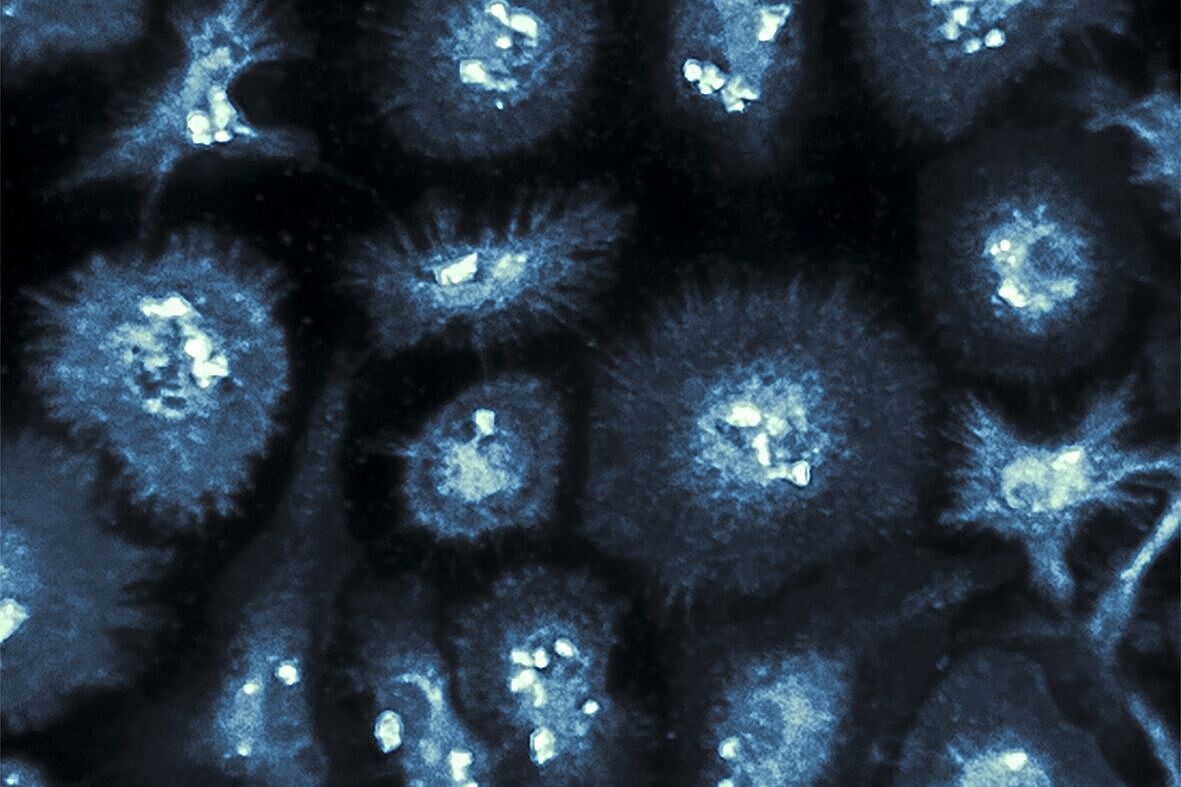 Image shows brain immune cells (“microglia”) in culture exposed to amyloid-beta proteins which are involved in Alzheimer’s disease.