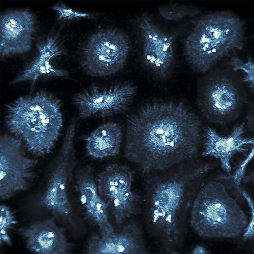 Bild zeigt Immunzellen des Gehirns („Mikroglia“) in Zellkultur, die Amyloid-Beta-Proteinen ausgesetzt wurden. 