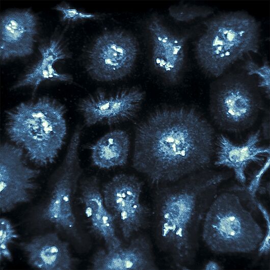 Image shows brain immune cells (“microglia”) in culture exposed to amyloid-beta proteins which are involved in Alzheimer’s disease.