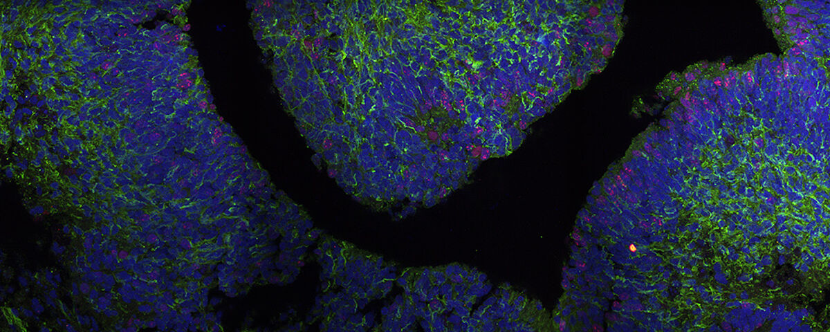 3D brain organoid that is used as a model system to study Parkinson's disease. Source: DZNE 