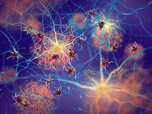 Artistic visualization of protein deposits in the vicinity of nerve cells