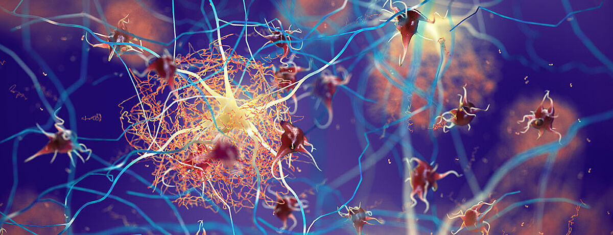 Illustration von Protein-Ablagerungen in der Umgebung von Nervenzellen, wie sie bei einer Alzheimer-Erkrankung auftreten.