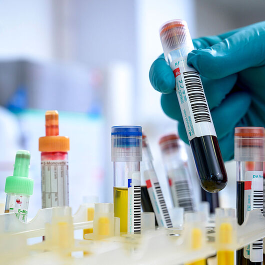 Symbolic image shows blood and urine samples.