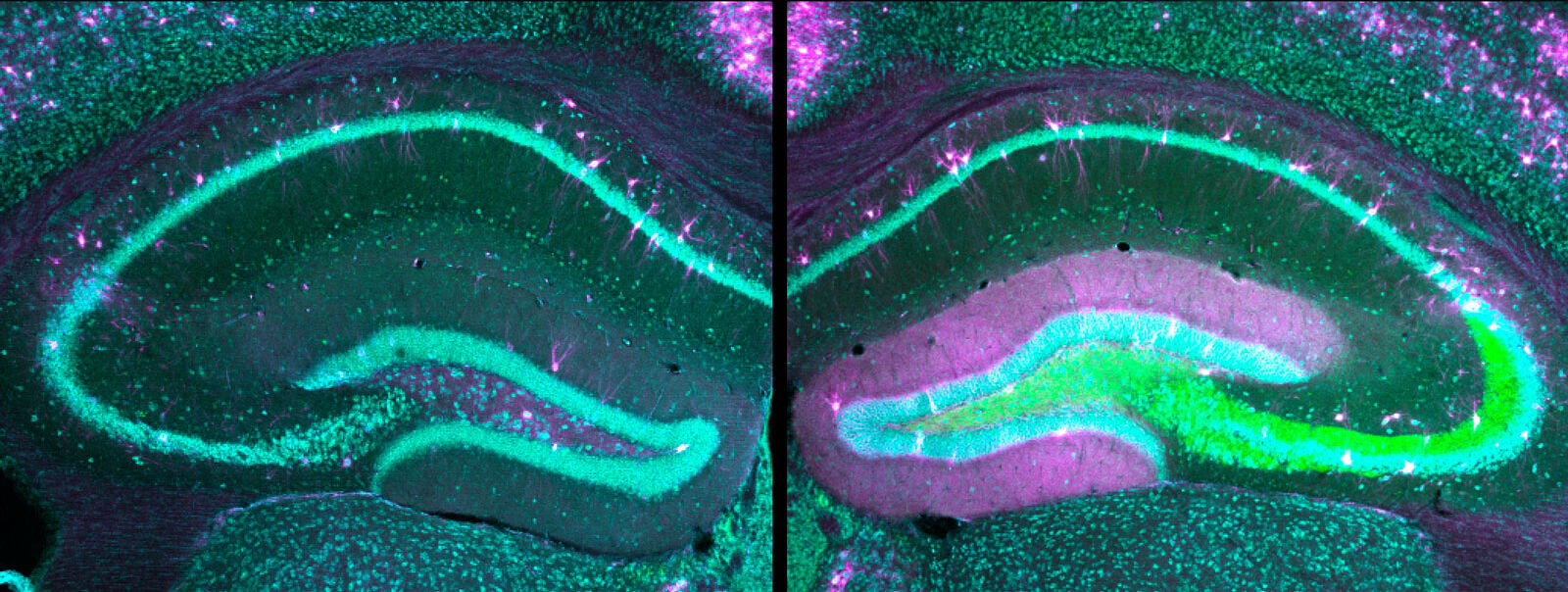 Das Bild zeigt Hirnschnitte durch die Gedächtnisregion (Hippokampus) einer gesunden Maus (links), und einer epileptischen Maus mit HCN1-Mutation (rechts)