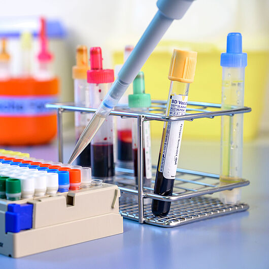 Image shows blood samples