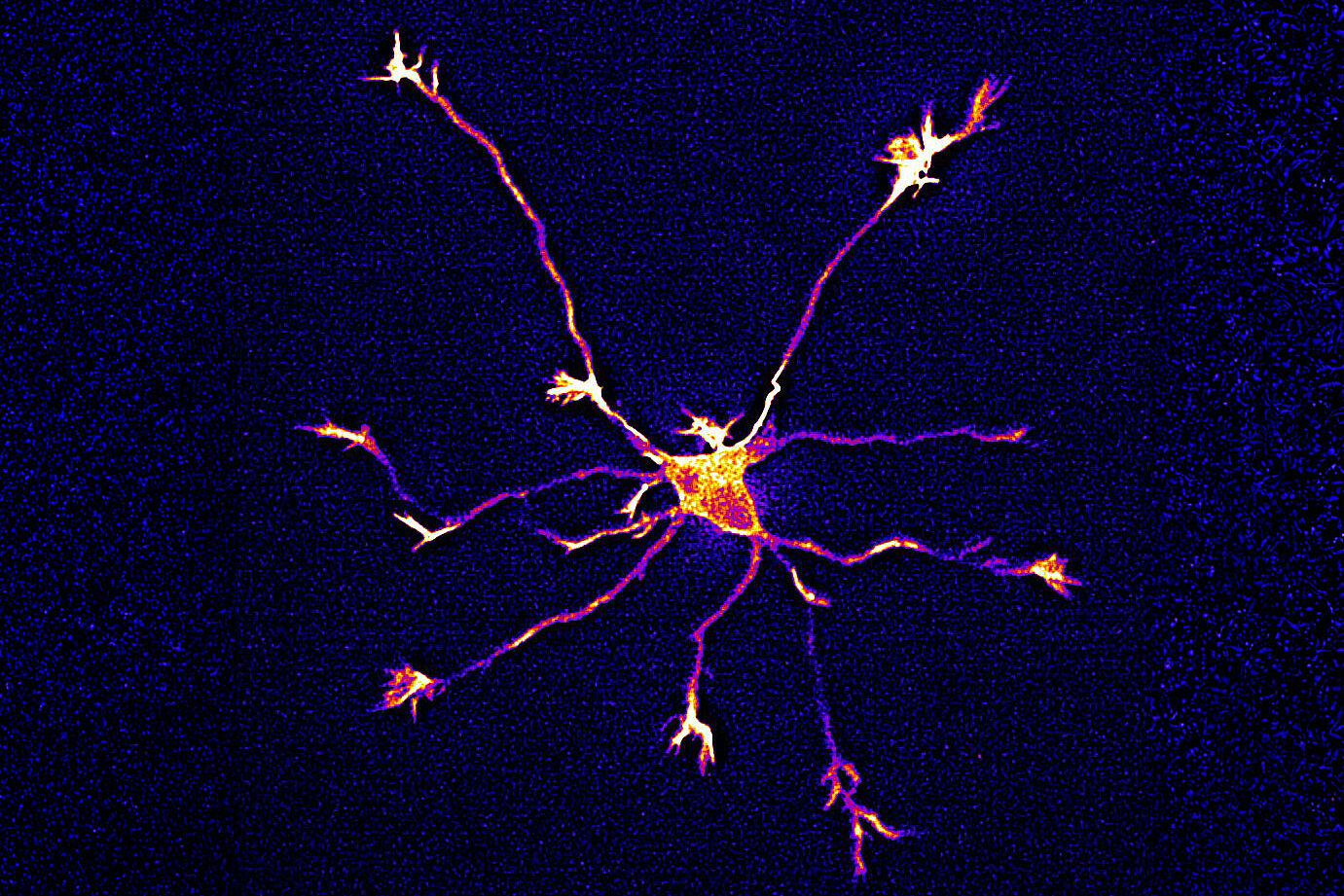 The image shows a growing nerve cell with several extensions, viewed under a fluorescence microscope. The cell body in the center of the image glows yellow-orange and gives way to numerous long, branched extensions that radiate outward. The extensions appear in shades of orange and violet against a dark blue background.