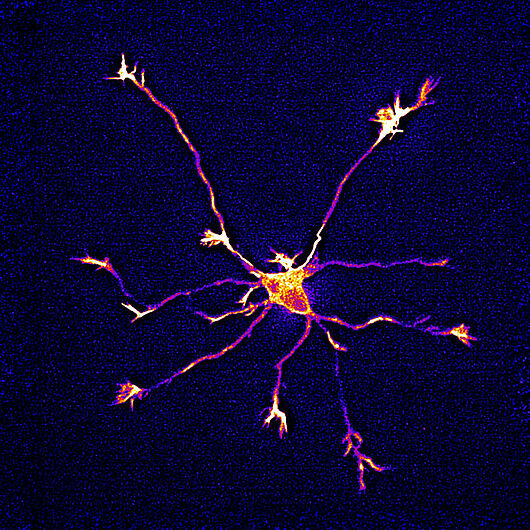 The image shows a growing nerve cell with several extensions, viewed under a fluorescence microscope. The cell body in the center of the image glows yellow-orange and gives way to numerous long, branched extensions that radiate outward. The extensions appear in shades of orange and violet against a dark blue background.