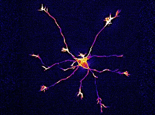 Das Bild zeigt eine wachsende Nervenzelle mit mehreren Fortsätzen, betrachtet unter dem Fluoresenzenzmikroskop. Der Zellkörper in der Bildmitte leuchtet gelb-orange und geht in zahlreiche lange, verzweigte Fortsätze über, die sich strahlenförmig ausbreiten. Die Fortsätze erscheinen in Orange- und Violetttönen vor einem dunkelblauen Hintergrund.