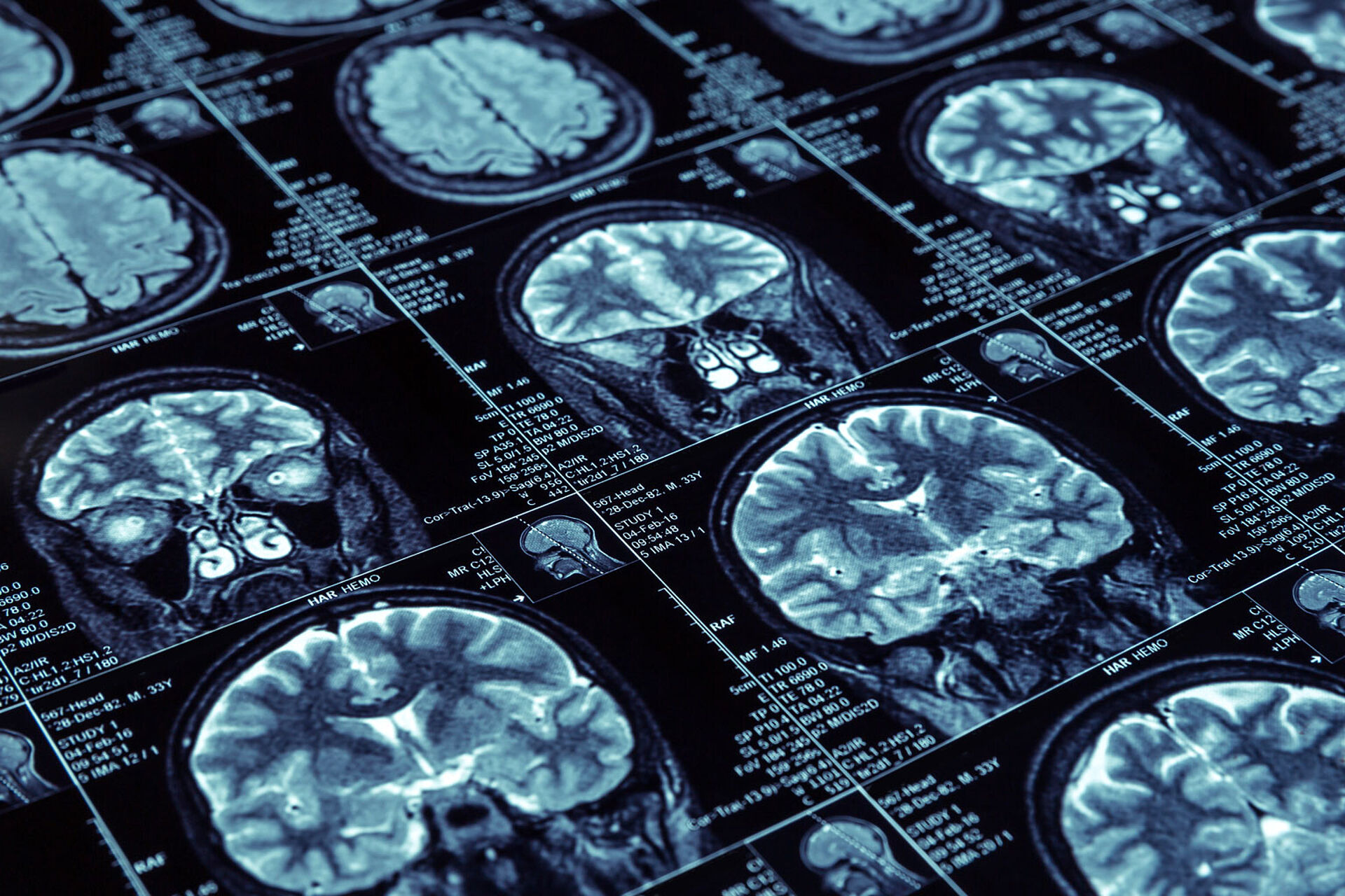 The image shows numerous MRI scans of the human head and brain arranged in different cross-sectional views. Technical examination data are displayed alongside the individual scans.