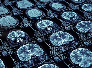 The image shows numerous MRI scans of the human head and brain arranged in different cross-sectional views. Technical examination data are displayed alongside the individual scans.