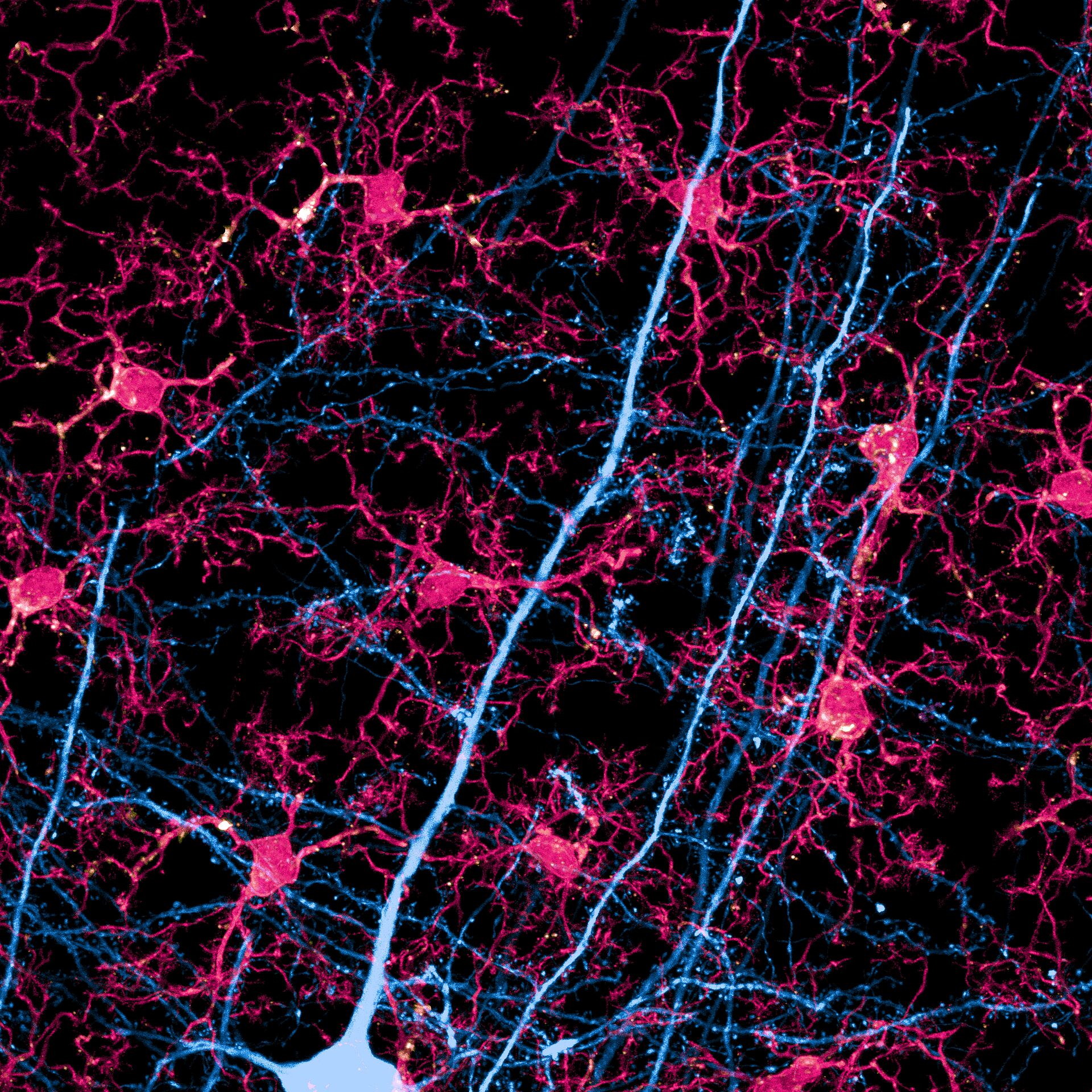 Fortsätze einer Nervenzelle (blau) und Mikroglia (rot) unter dem Mikroskop. 