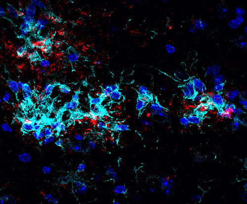 Die Abbildung zeigt auf diese Weise stimulierte Mikroglia (cyan), die sich um Ablagerungen von Proteinen – sogenannte Plaques (rot) - sammeln und diese abbauen.
