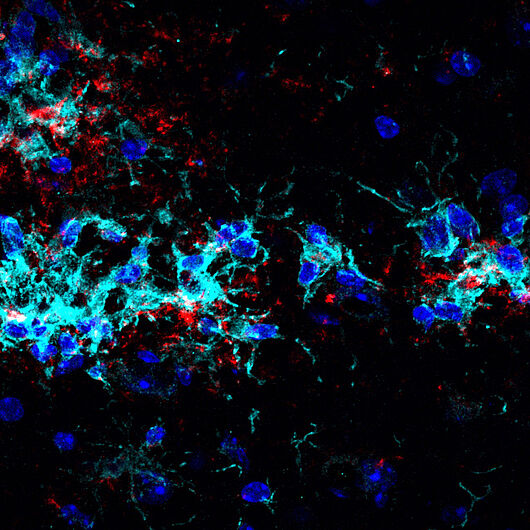 This image shows microglia (cyan) stimulated in this way, which gather around deposits of proteins - called “plaques” (red) - and break them down.