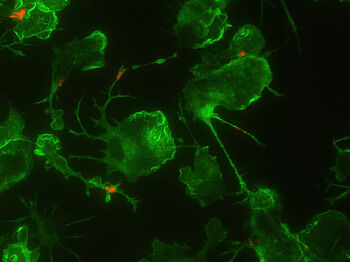 Das Mikroskopiebild zeigt Mikroglia (grün), die Amyloid-beta (rot) phagozytieren.