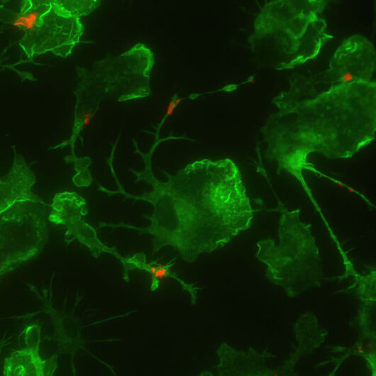 This microscopy image shows microglia (green) phagocytosing amyloid-beta (red).