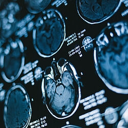 The image shows multiple MRI scans of the human head and brain in different cross-sectional views. The blue-toned medical images are displayed on a screen alongside technical examination data.