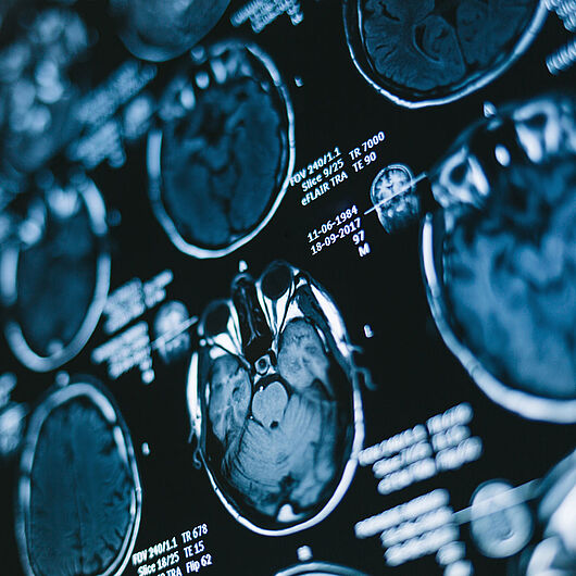 The image shows multiple MRI scans of the human head and brain in different cross-sectional views. The blue-toned medical images are displayed on a screen alongside technical examination data.