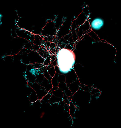 Nervenzelle aus den dorsalen Wurzelganglien unter dem Mikroskop